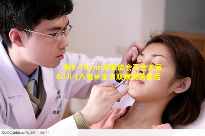 割8-10mm双眼皮会不会太宽 🐅 (八毫米全切双眼皮恢复后多宽)